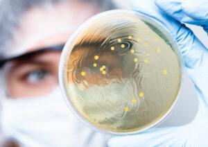 Petri dish observation